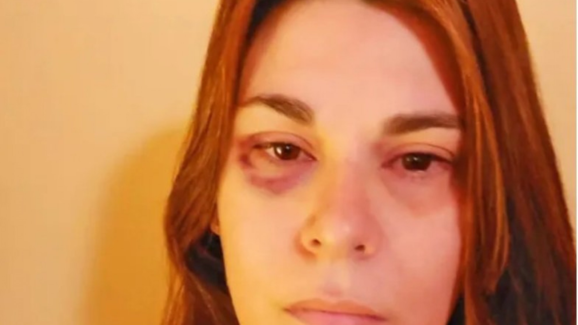 Alvear: la vicedirectora de una escuela terminó con un edema cerebral tras ser golpeada por la madre de un alumno